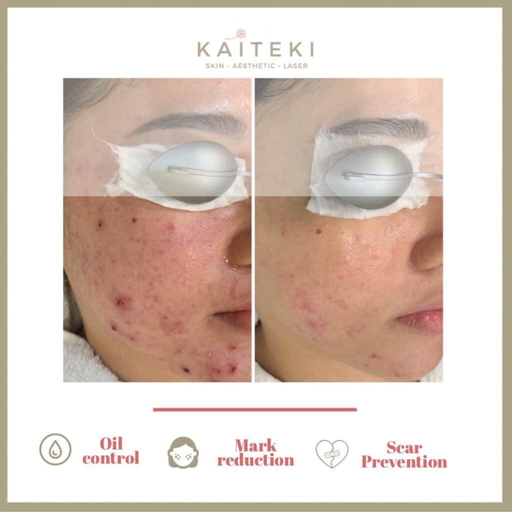 5 Top Dermatologists in JB Who Can Transform Your Skin!