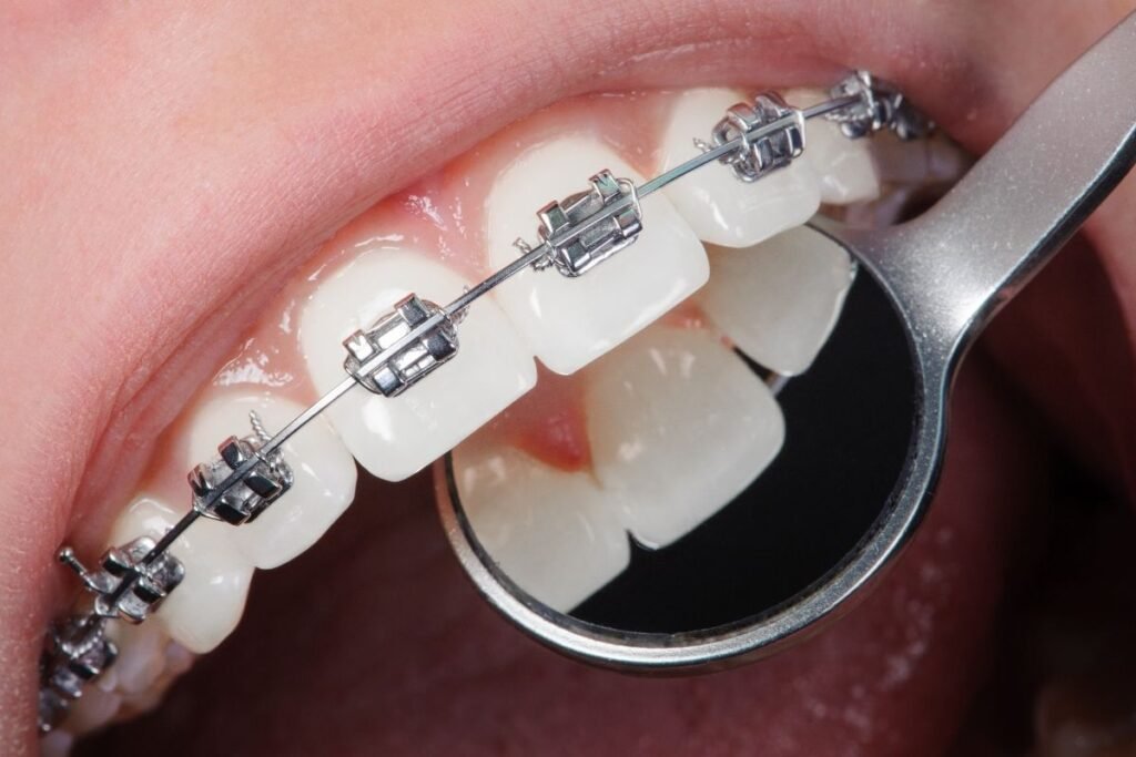 Don’t Wait for the Pain | Why United Dental Surgery is the Smarter Choice for Your Family