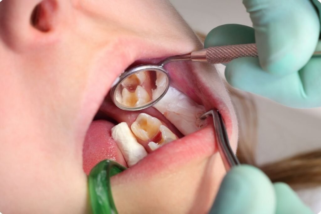 Dental Scams For Every Singaporean?
