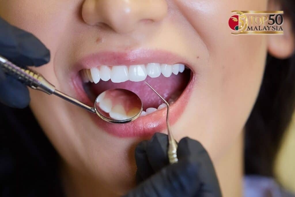 Why Smart Residents Always Look for a Yishun Dentist Recommend Tag Before Booking
