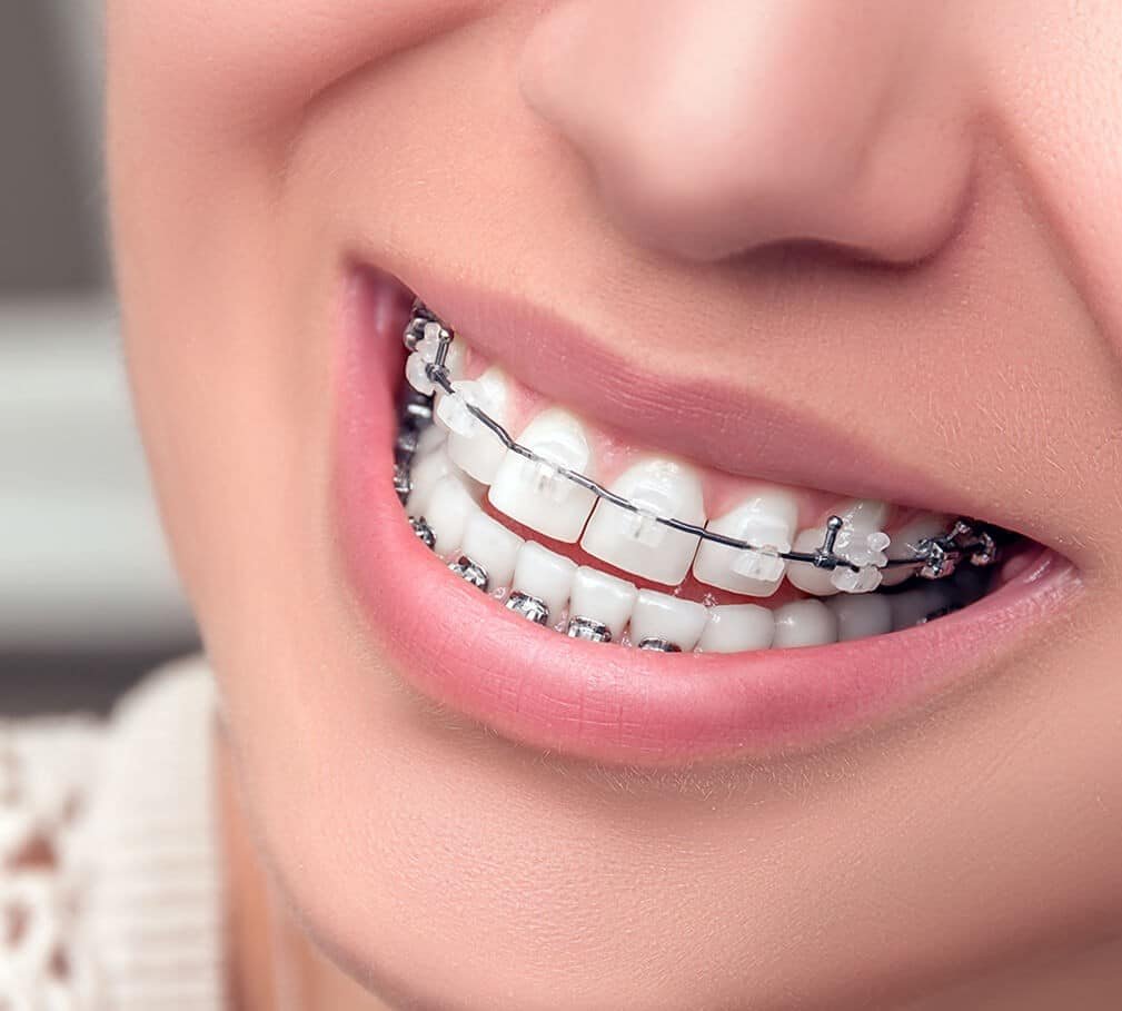 Ang Mo Kio Dental Recommend 2026