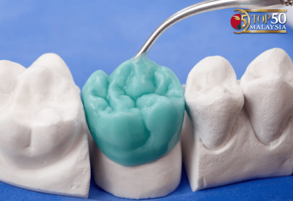 Wisdom tooth extraction surgery